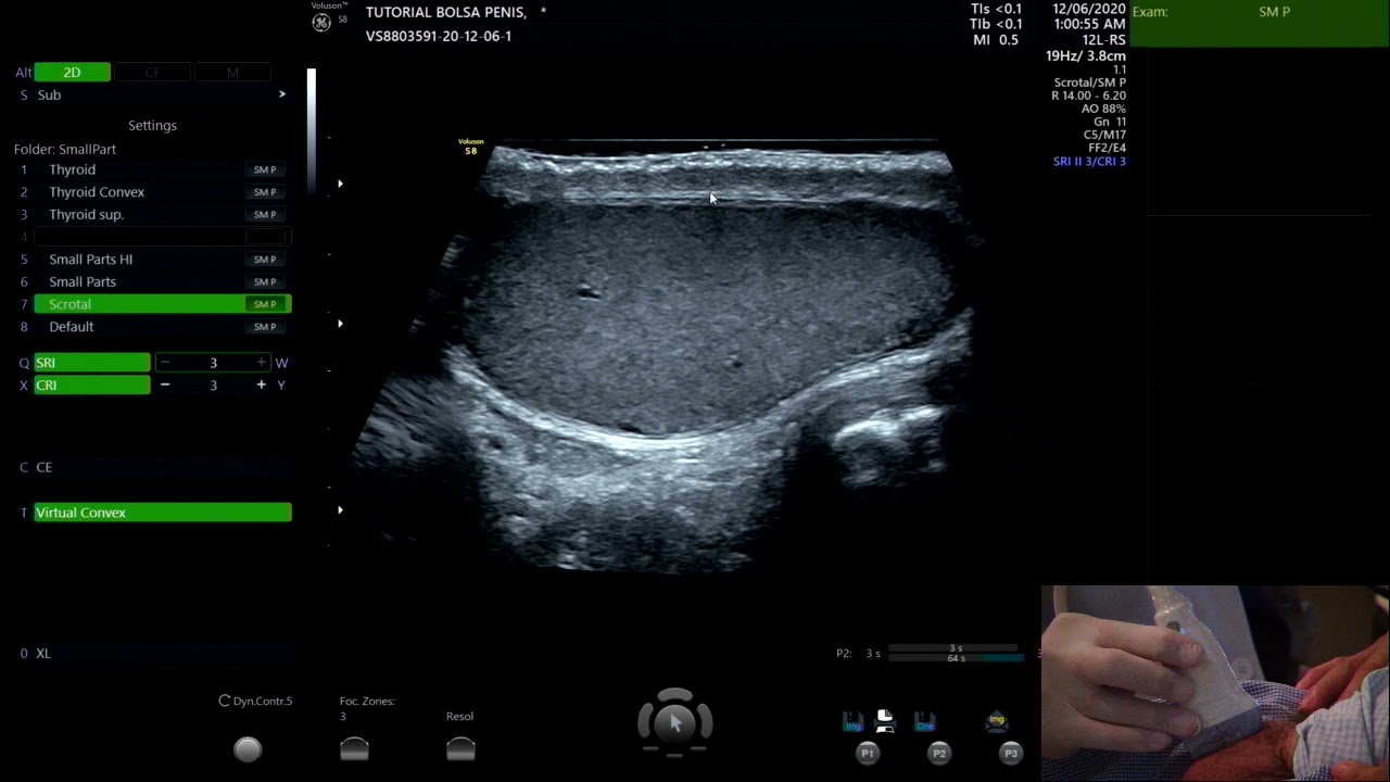 Tutorial de ultrassonografia da bolsa testicular e pênis  Vol