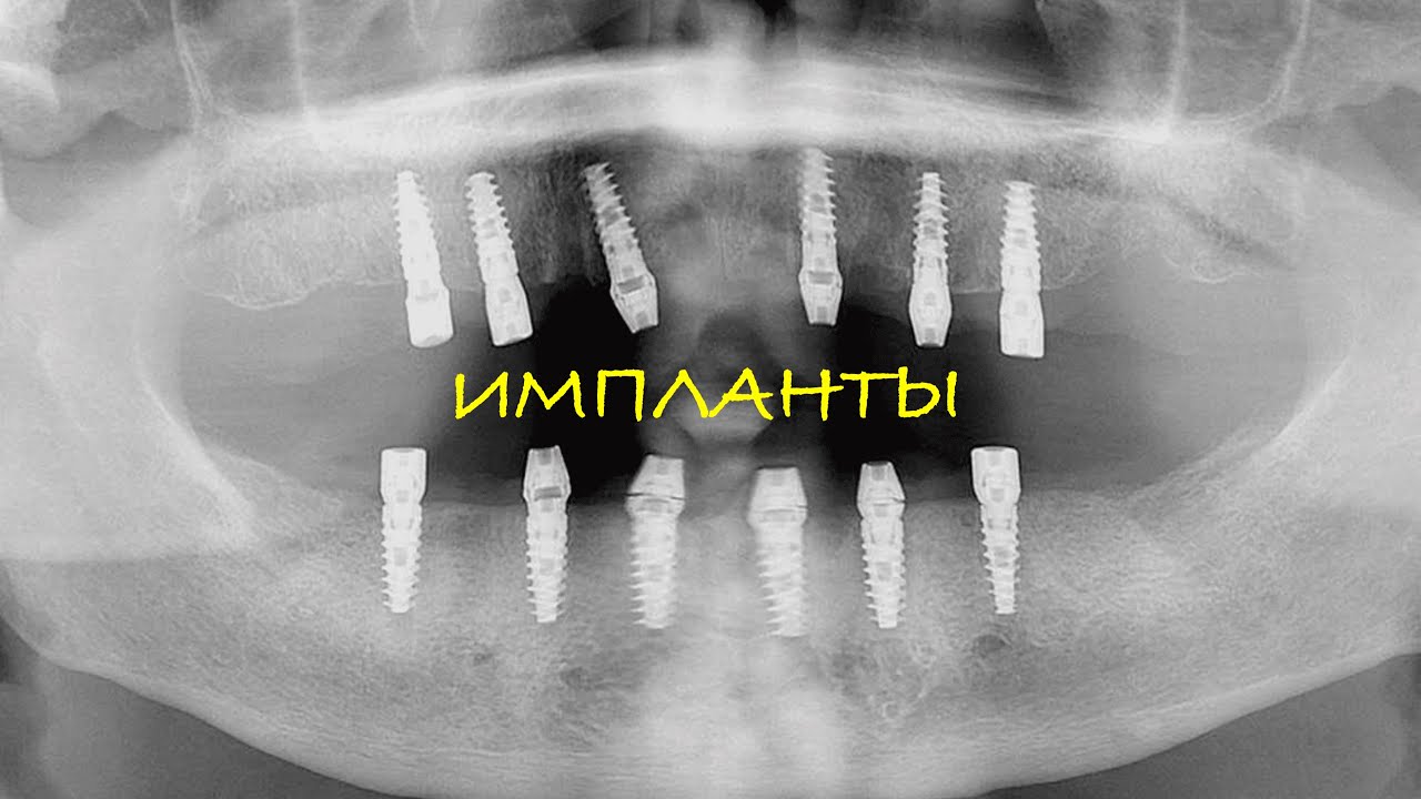 Почему те, кто ЗНАЕТ делают Съёмные?!
