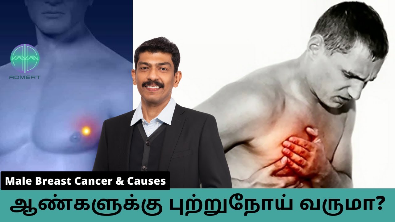 Mens breast cancer awareness Causes , Symptoms and Treatment | Dr.Ravindreankumeran in Tamil