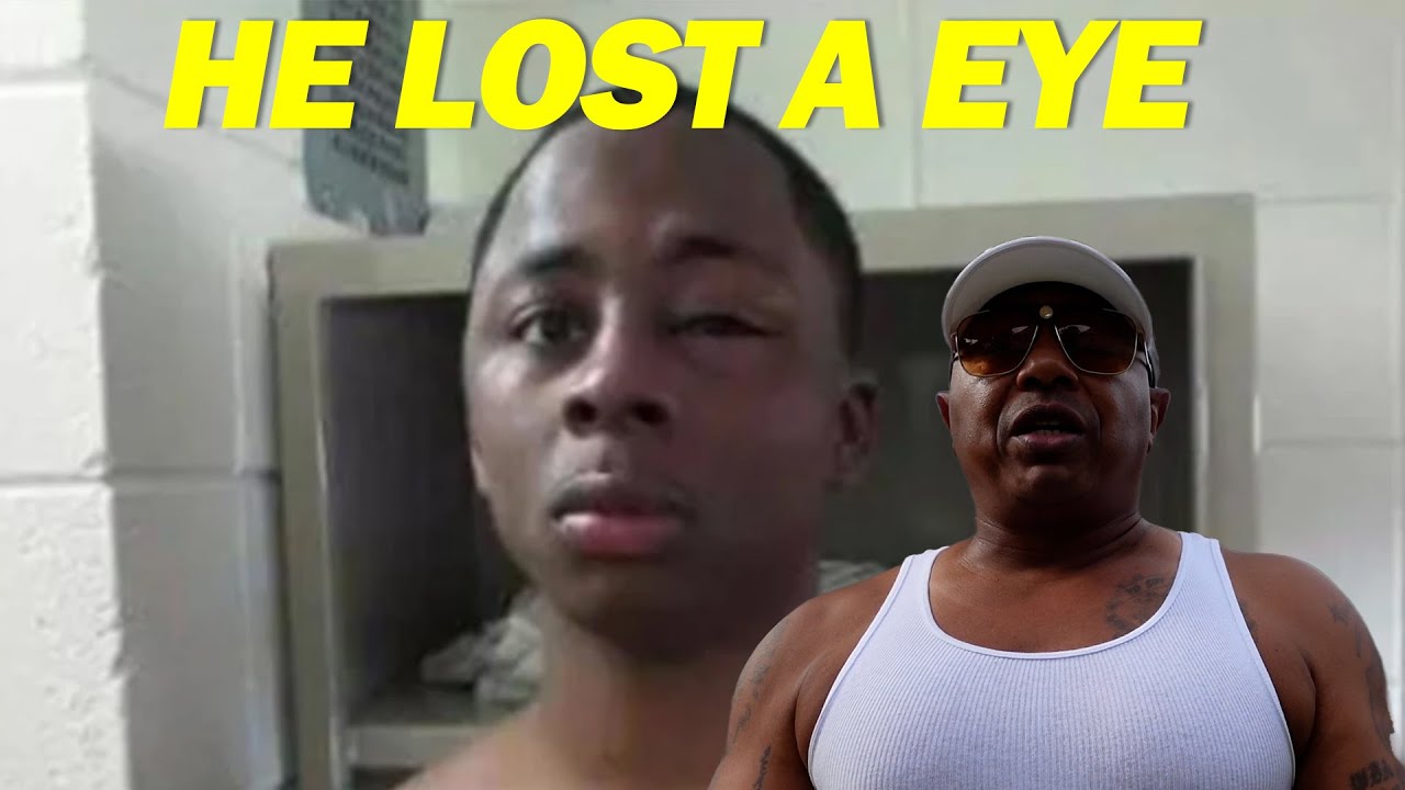 LOSING A EYE IN PRISON!