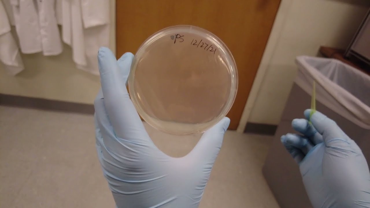 How to revive bacteria from -80 and get single colonies on an agar plate (specifically for Danielle)