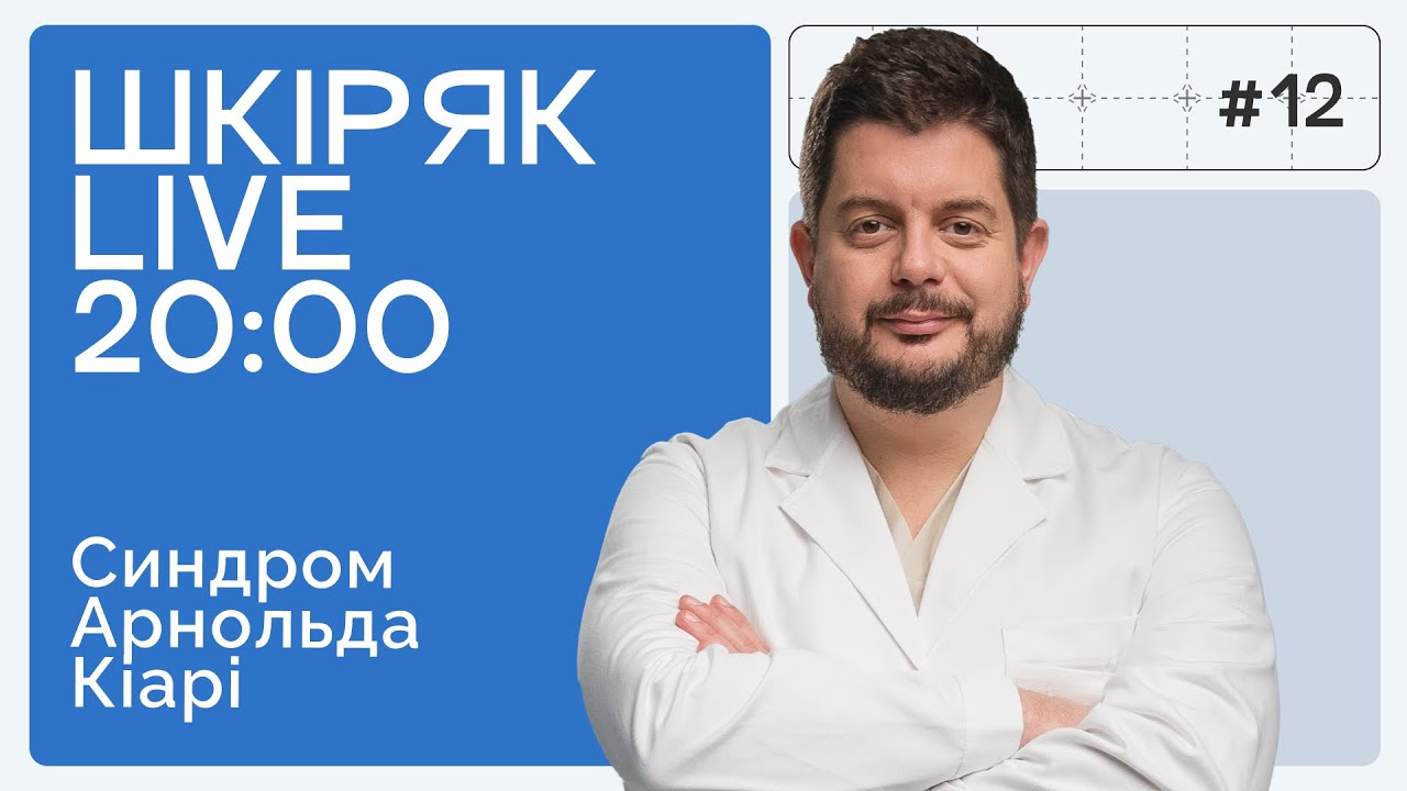 Синдром, який часто плутають з мігренню! | ШКІРЯК LIVE.