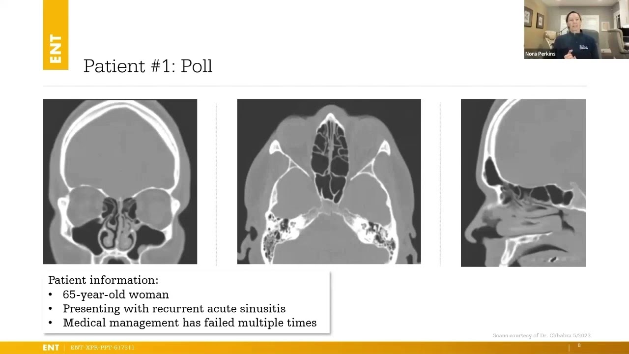 Tools for successful sinus patient outcomes