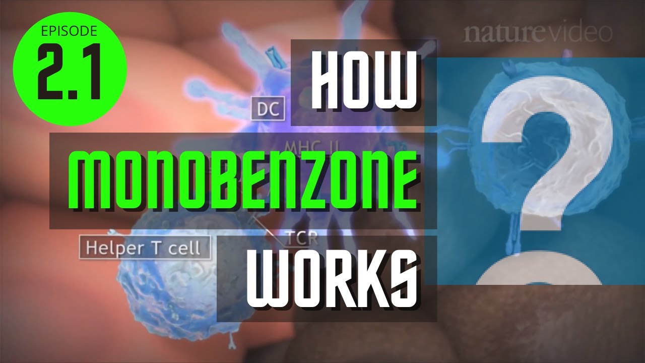 Ep 2.1- How Monobenzone Works?