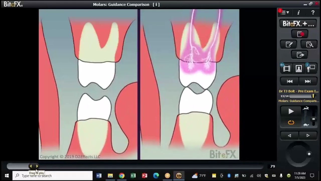 Greatly Increase Treatment Acceptance Rates Using This! - Dr. TJ Bolt's Pre-Exam Interview