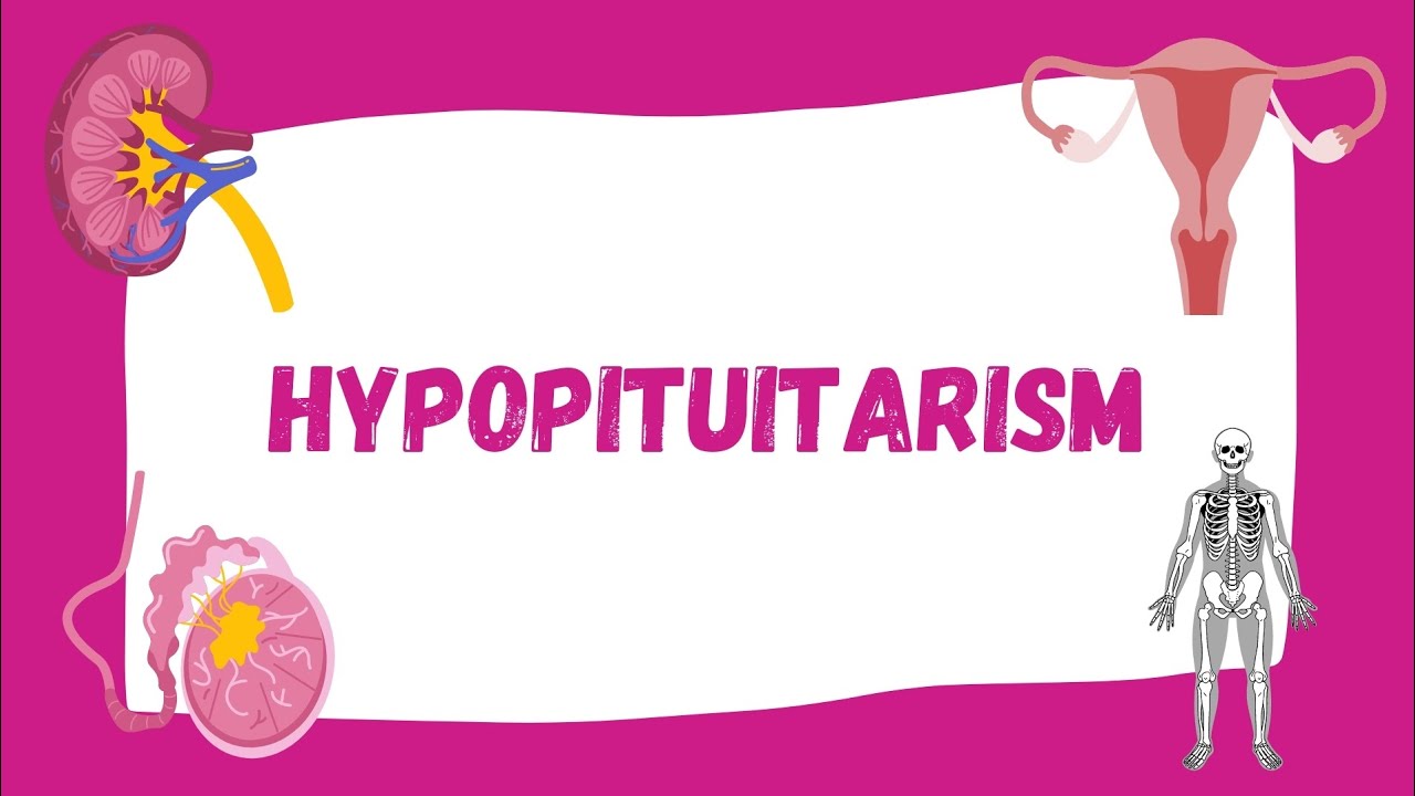 Hypopituitarism | Causes, Symptoms, Diagnosis, Treatment | Endocrinology