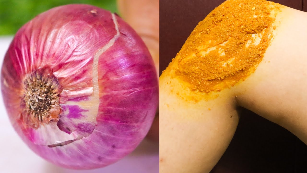 एक ही बार में मेरे घुटनों का दर्द और सूजन जड़ से ख़त्म हो गई knee pain home remedy घुटने का दर्द