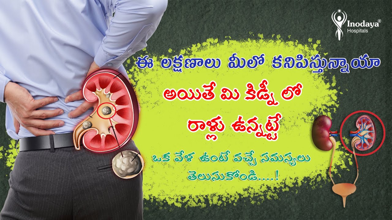 Kidney Urinary Bladder Symptoms & Kidney Stone Pain Symptoms/ Inodaya hospitals