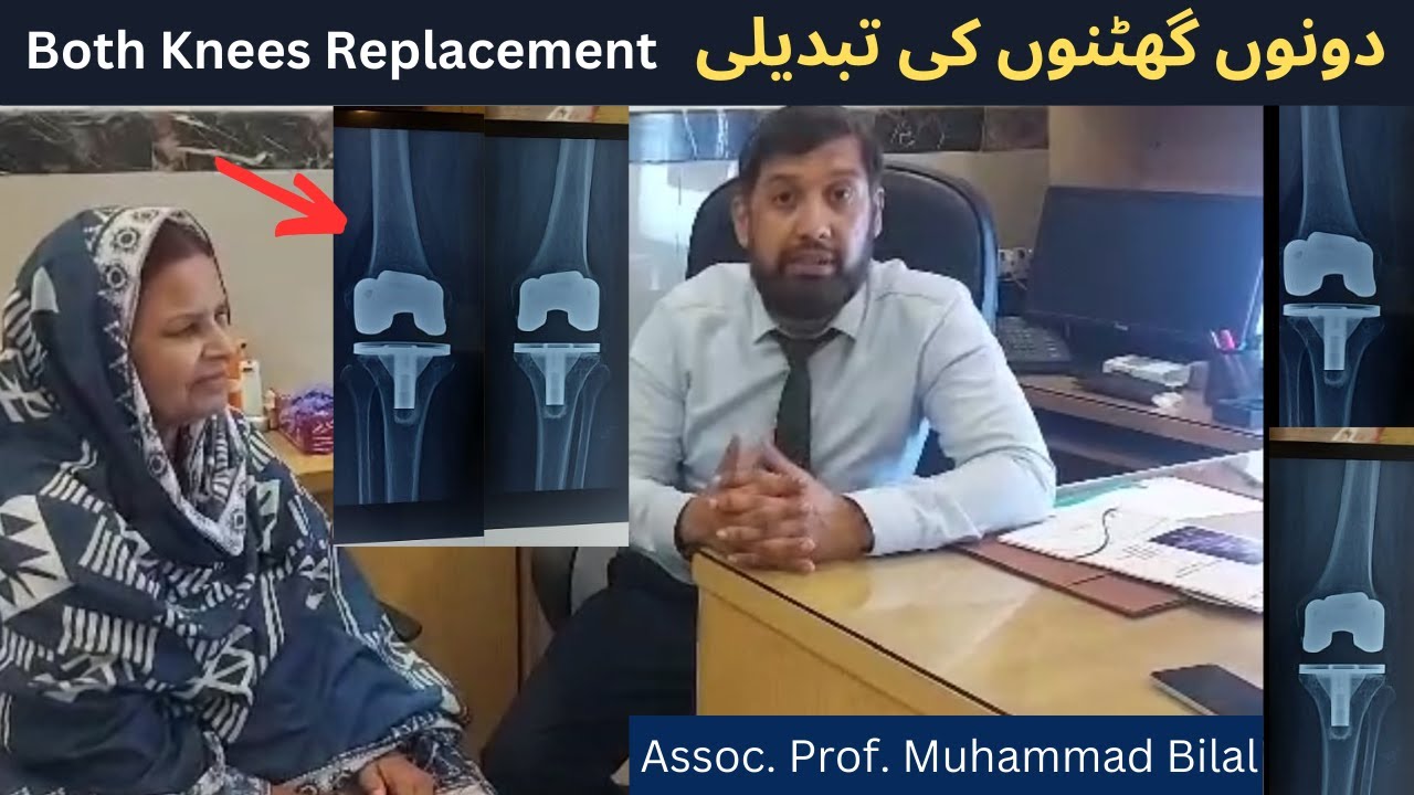 Both Knees Replacement Happy Patient Review Urdu in Lahore Pakistan
