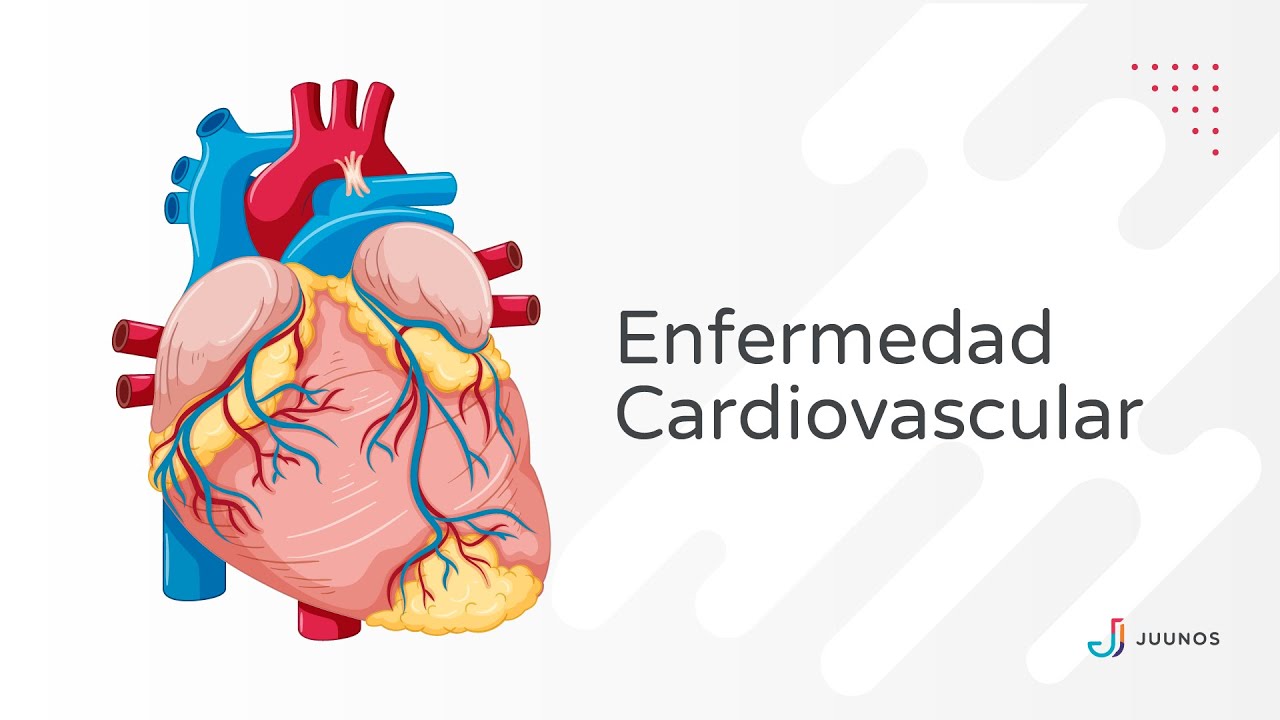 Todo lo que debes saber sobre Enfermedad Cardiovascular o Enfermedad Cardiaca.