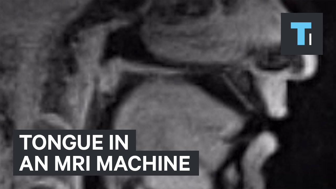 Tongue in a MRI machine