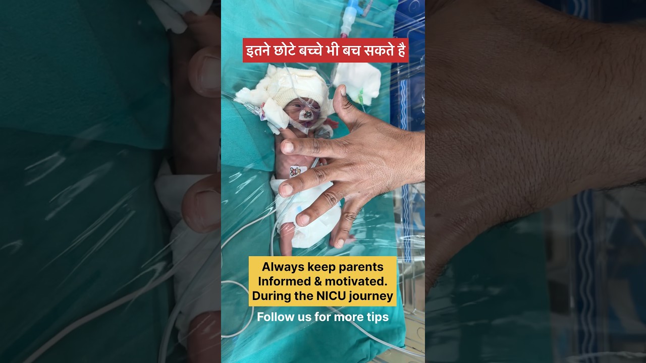 Tiny baby #baby #premature #tinybaby #neonate #neonatologist #babies #nicu #nursing #nicucare