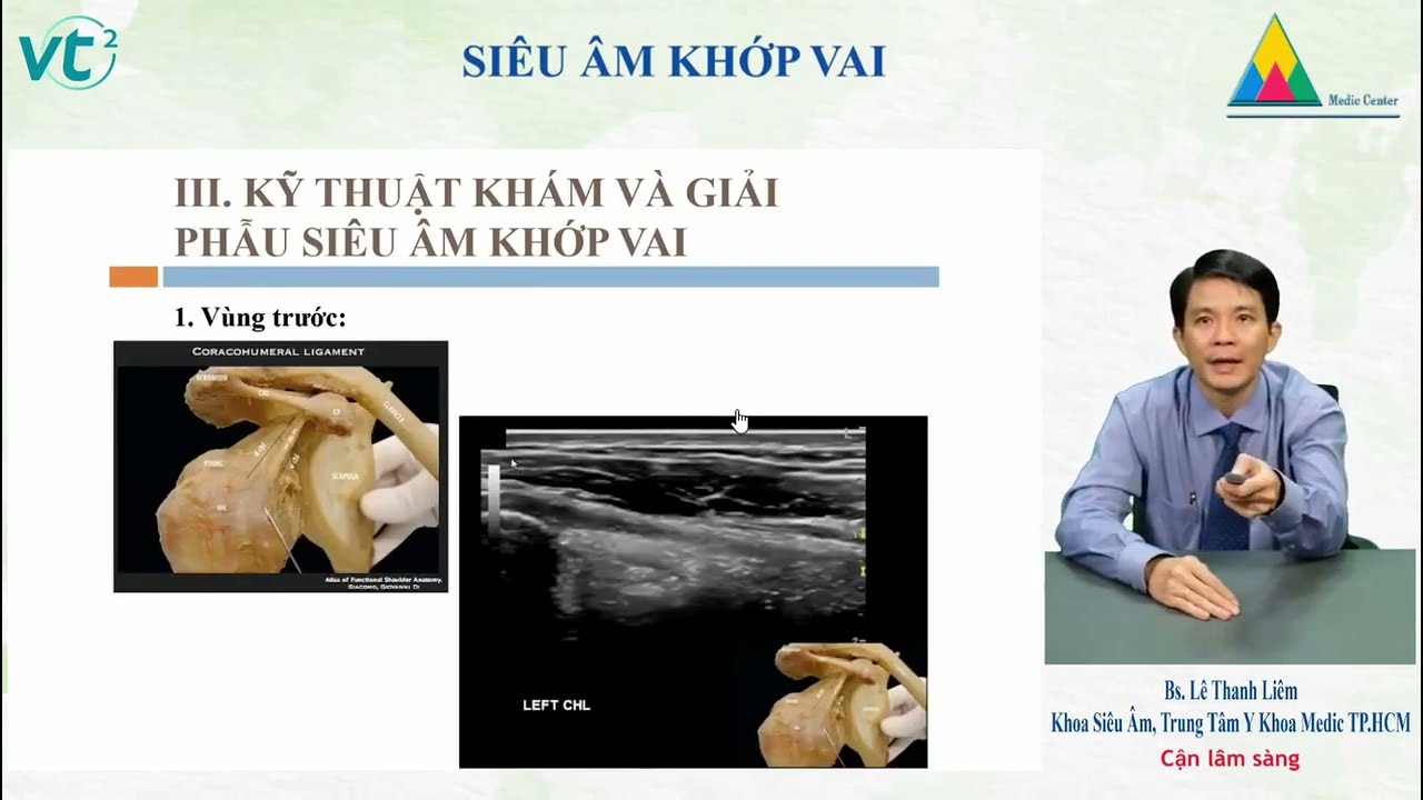 SIÊU ÂM KHỚP VAI | BS. Lê Thanh Liêm