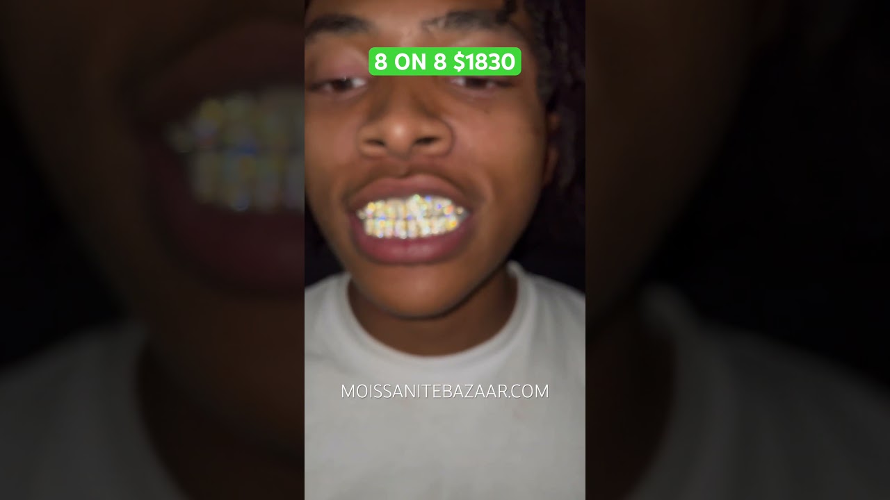 8 on 8 VVS Moissanite Grillz on 925 Silver & Yellow Gold Plating | MOISSANITEBAZAAR.COM
