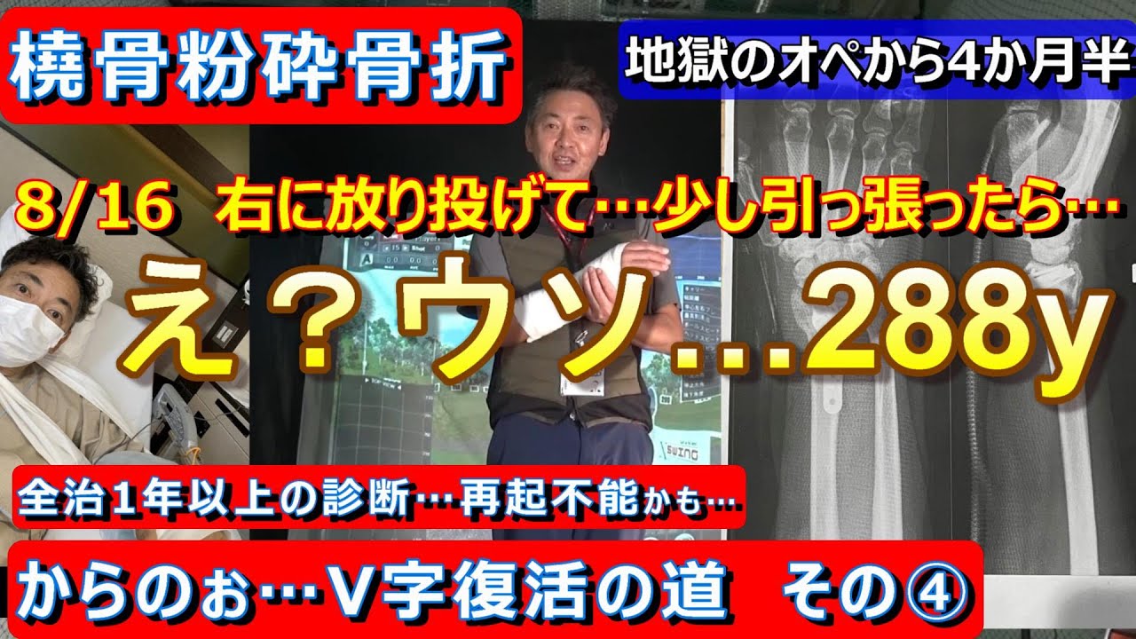 右手首粉砕骨折④　まだ手首にプレート入ってます！リハビリ中に○○を使ったら…288y？？？うっそー！