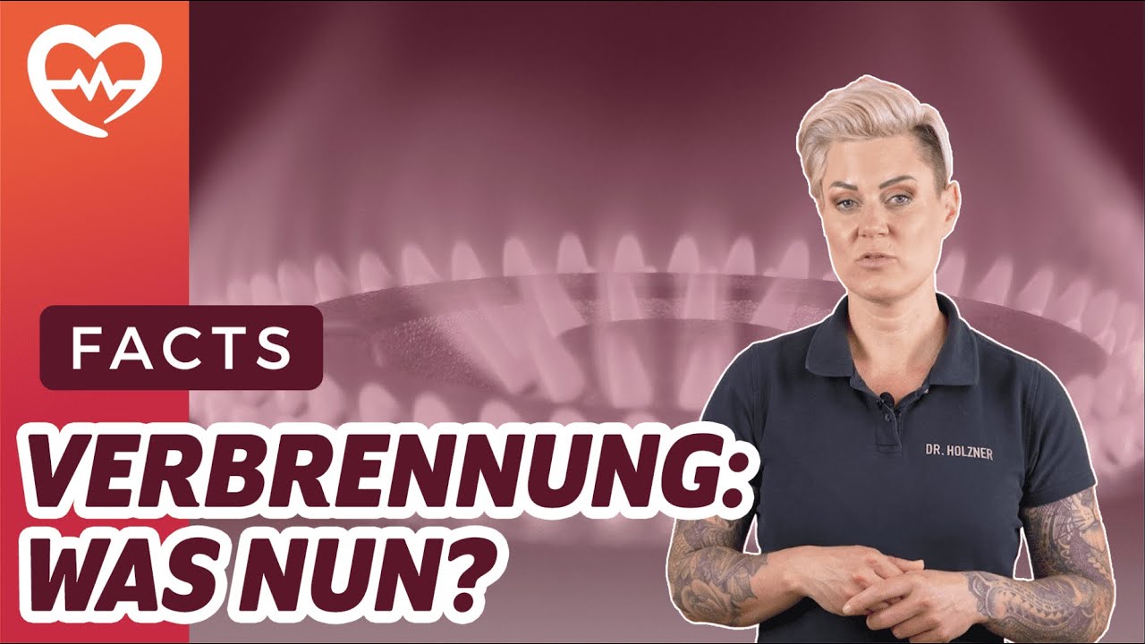 KÜHLEN ODER IN DIE NOTAUFNAHME? I VERBRENNUNGEN I FACTS I DOC CARO