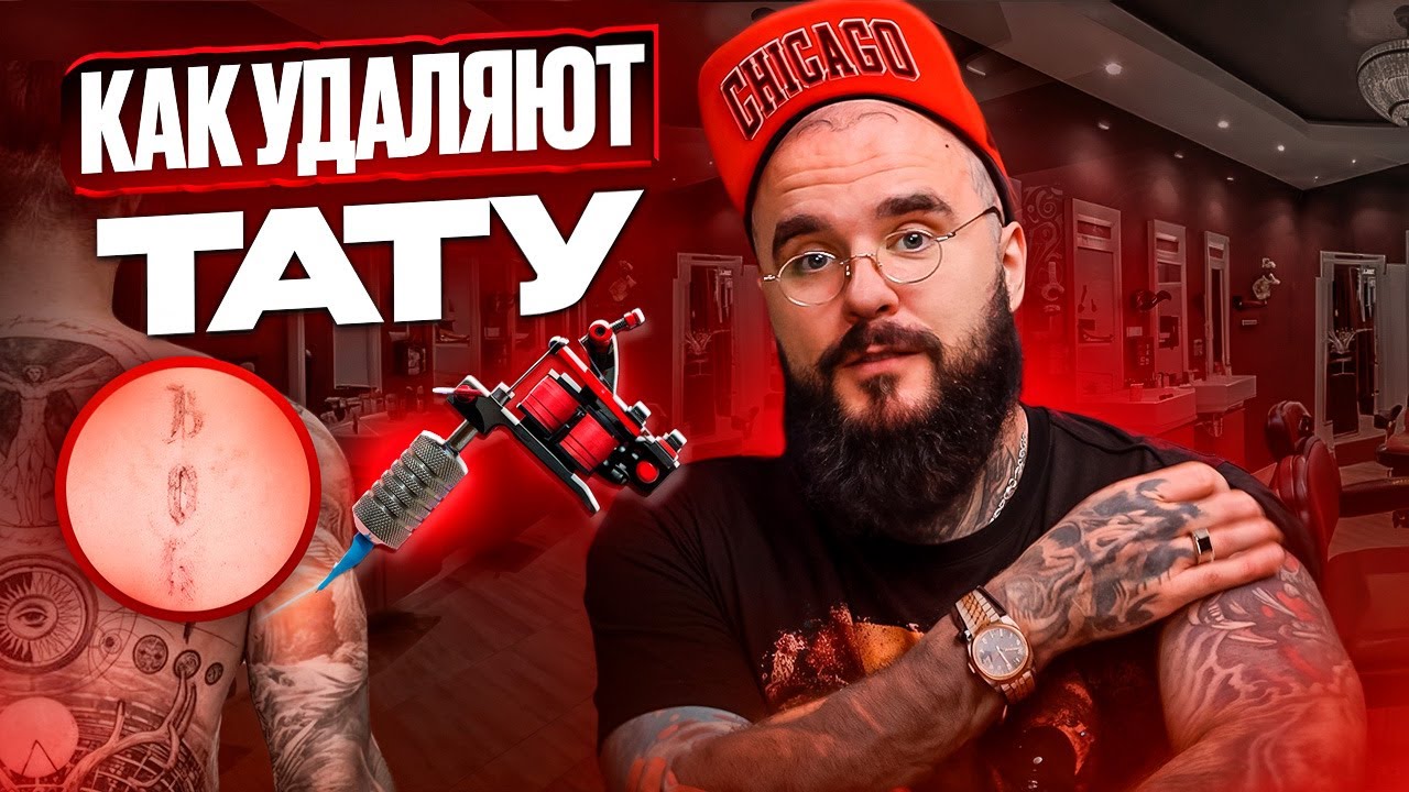ВОПРОС/ОТВЕТ ПРО УДАЛЕНИЕ ТАТУ 2025