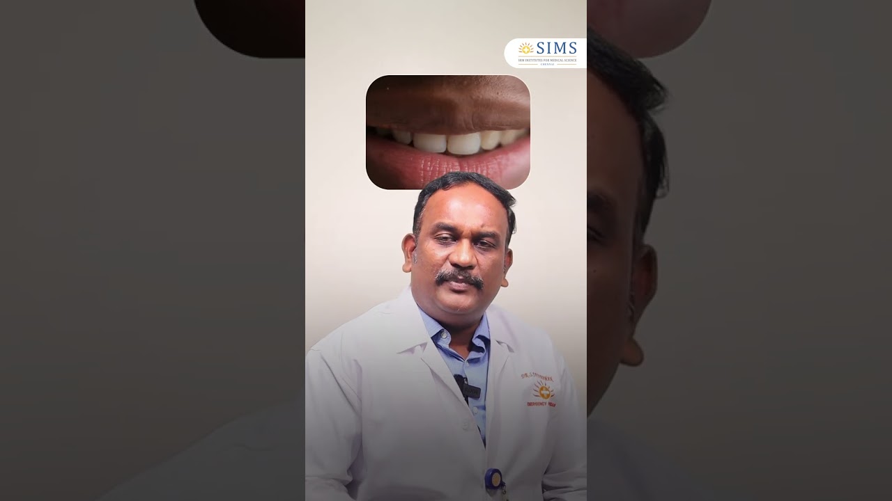 All You Need To Know About Stroke | SIMS Hospital Vadapalani Chennai
