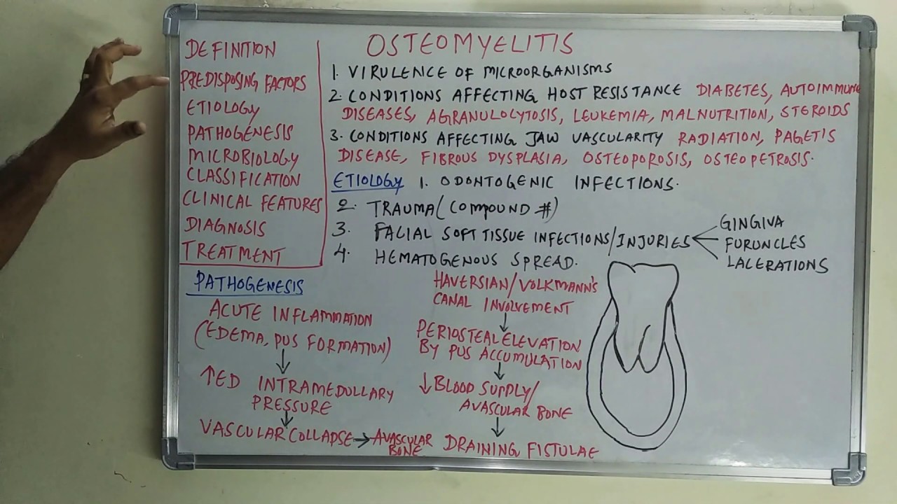 Остеомиелит - этиопатогенез и классификация
