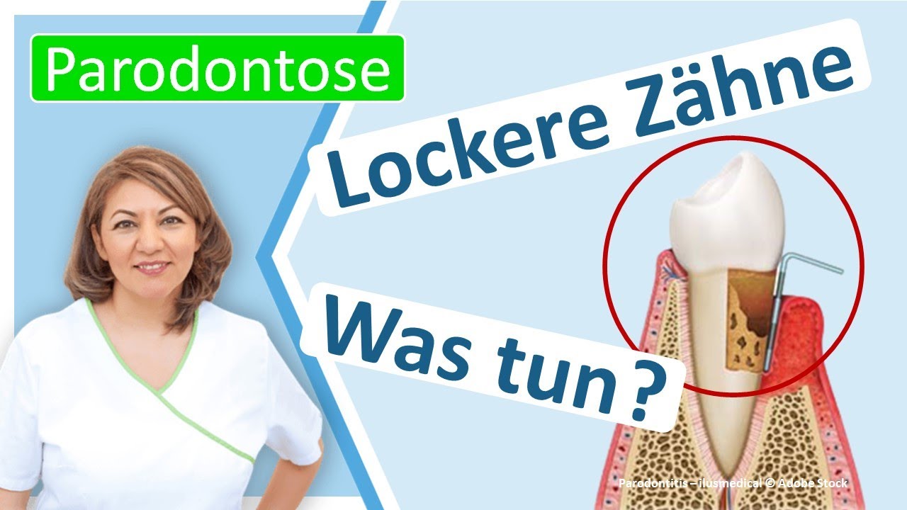 Parodontitis: Was kann man tun, wenn Z&auml;hne schon locker sind?  Zahnarztpraxis N. Redjai Gro&szlig;ostheim