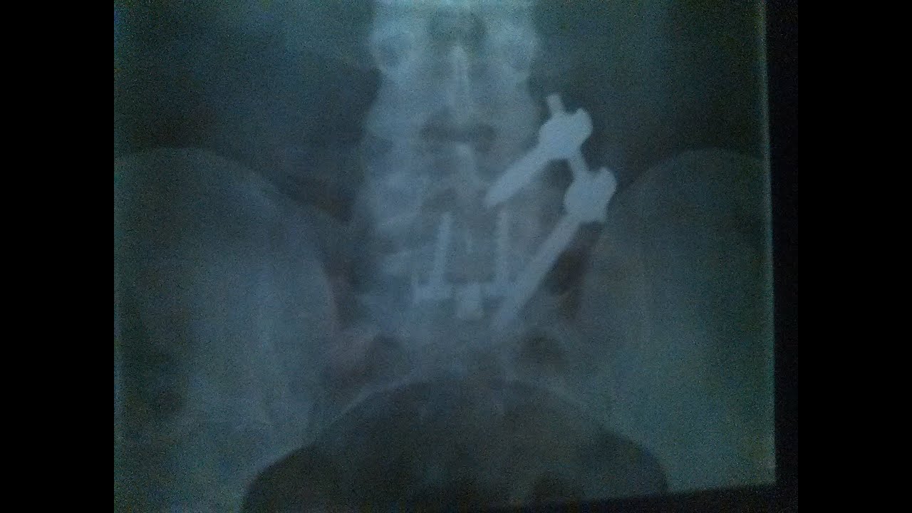 breaking your back busting your balls
