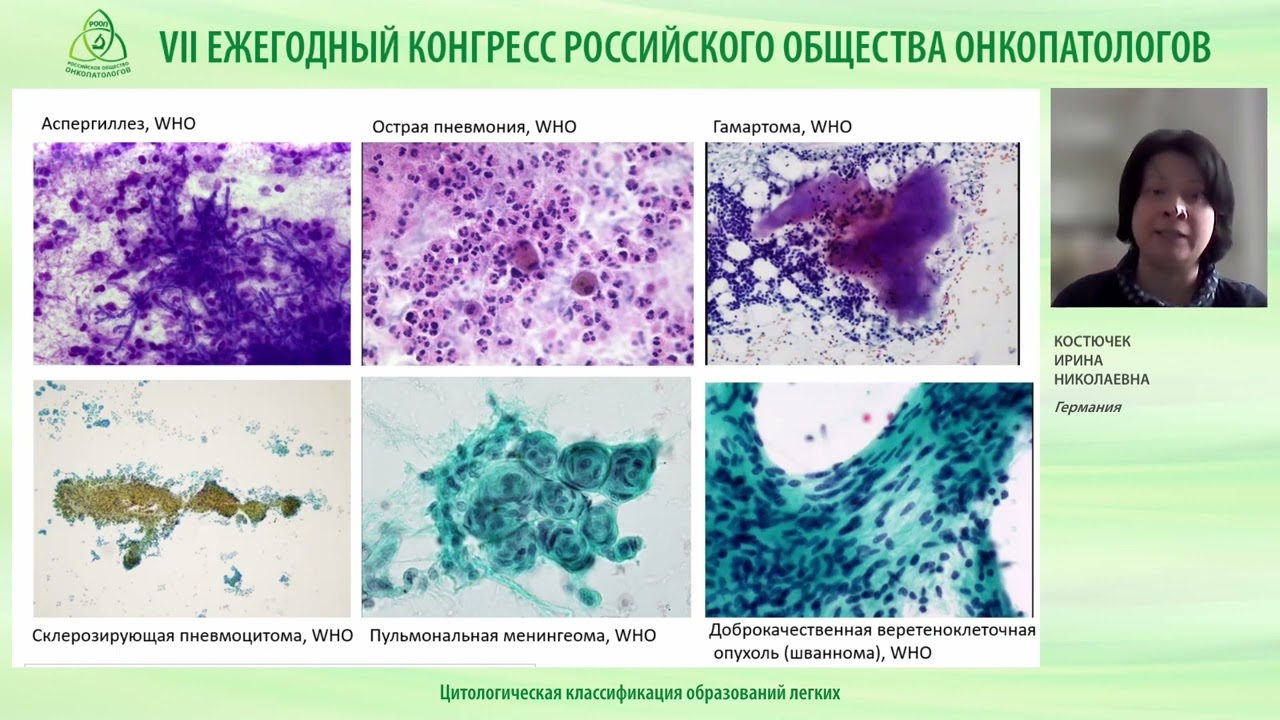Цитологическая классификация образований легких