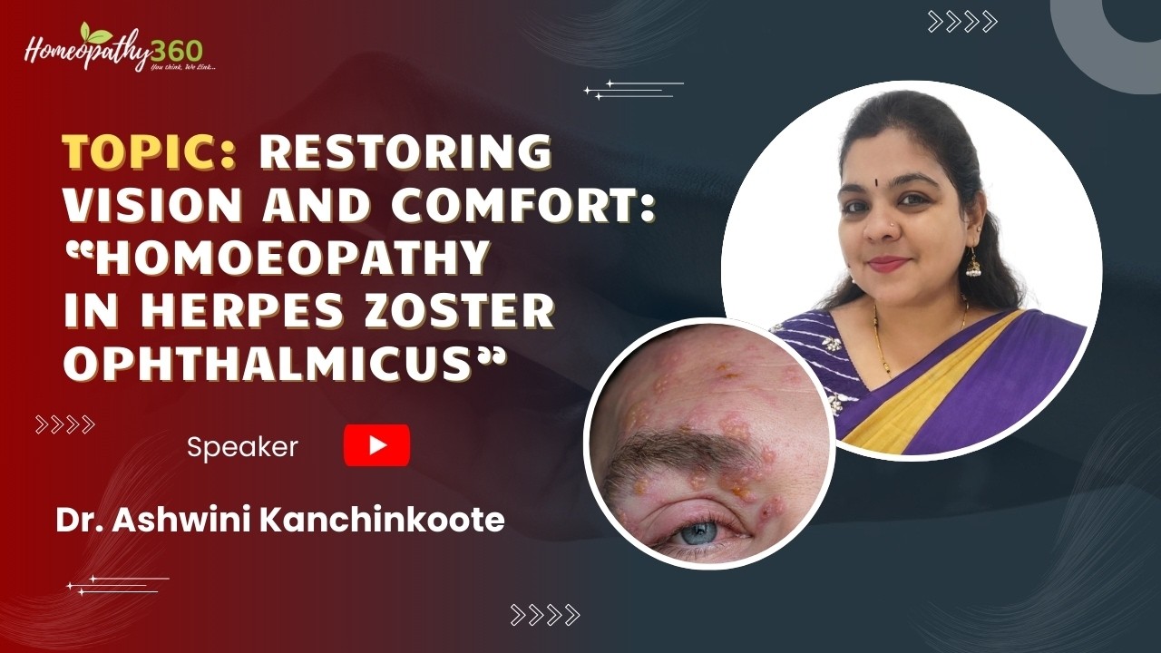 Restoring Vision & Comfort Homoeopathy in Herpes Zoster Ophthalmicus  Dr. Ashwini Kanchinkoote