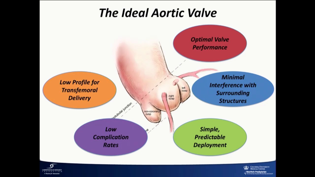 What Does the Field of Transcatheter Therapy Need Now? - Susheel Kodali, MD