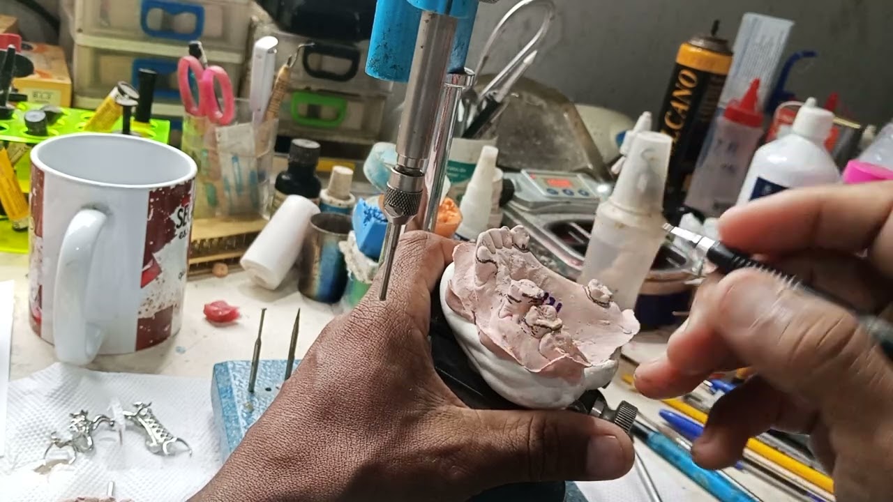 Delineando uma PPRG