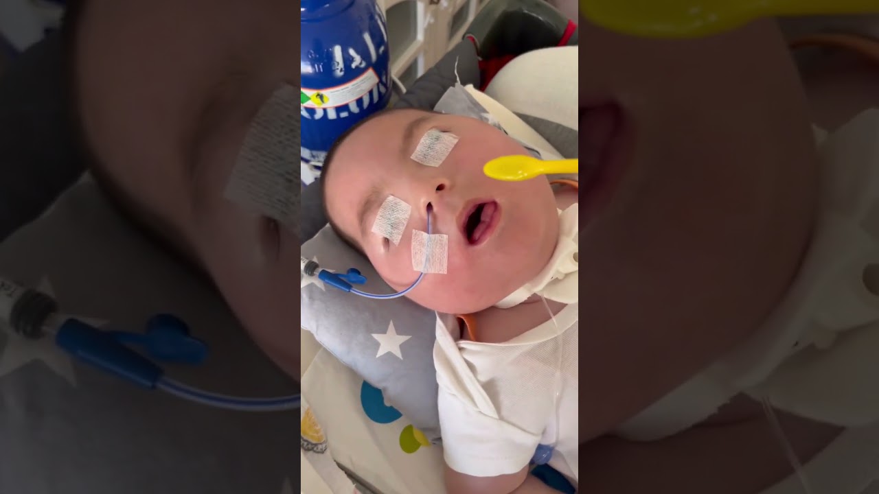 Ağız bakımı,Özel Gereksinimliler ağız bakımı için hap bilgi:6,#engelliağızbakımı#trakeostomi#reklam