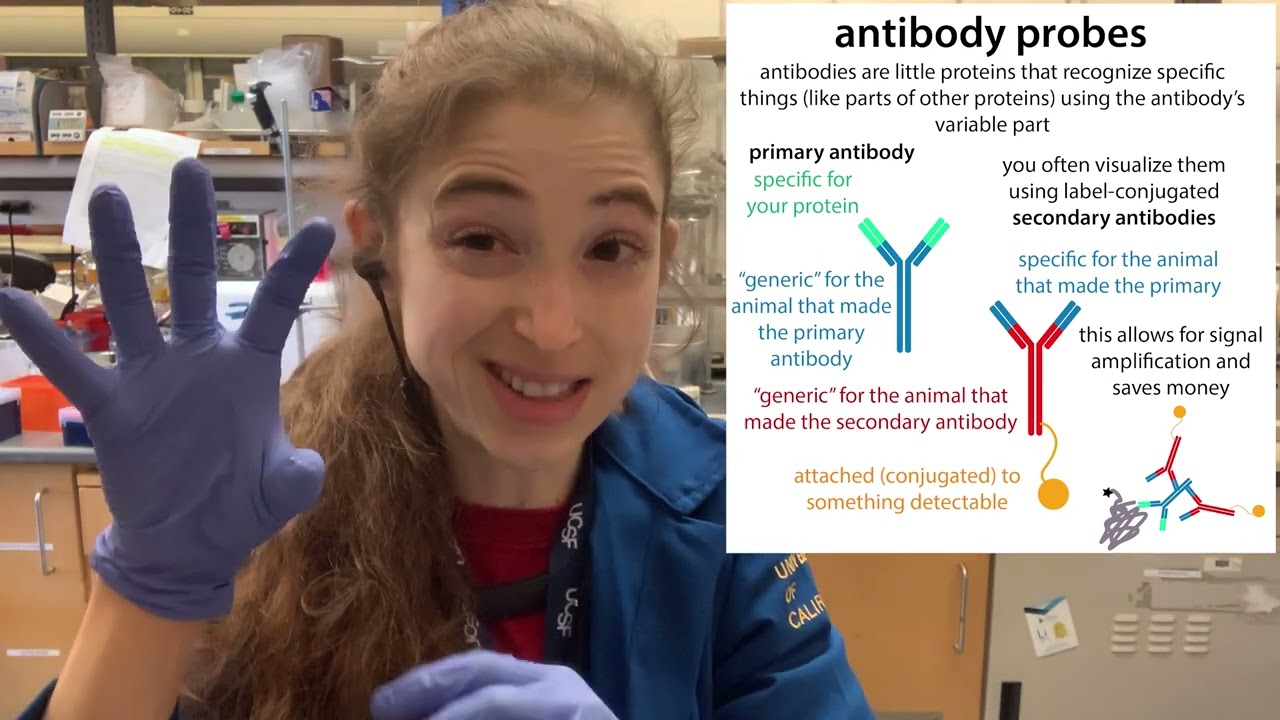 western blot boxes & other practical pointers for antibody probing (a random rambly labtips post)