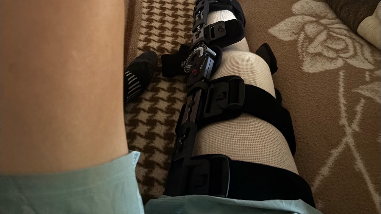 Rotura del tendón rotuliano. Proceso de rehabilitación y recuperación. (Patella tendon rupture)