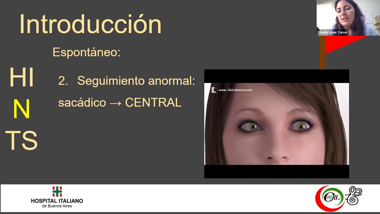 HINTS Plus - Ataxia - Banderas Rojas - El mes de la Otoneurología 2020