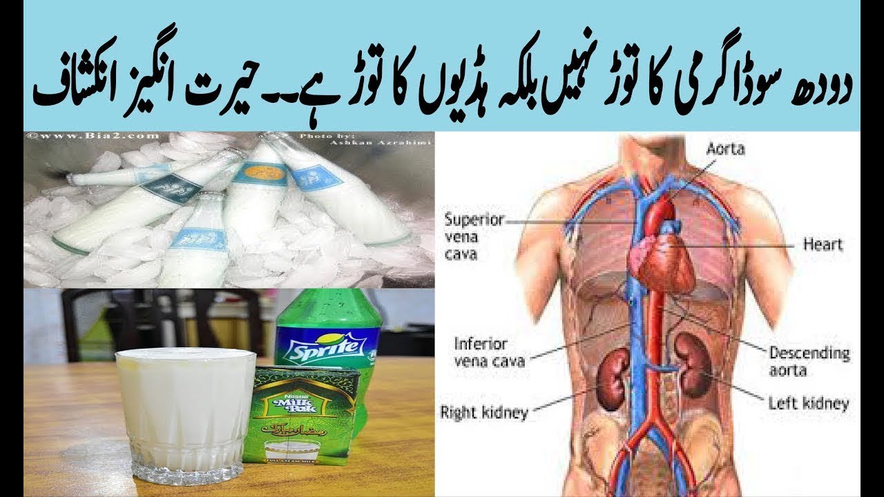 Doodh Soda is Very Dangerous - Health Ki Dunya