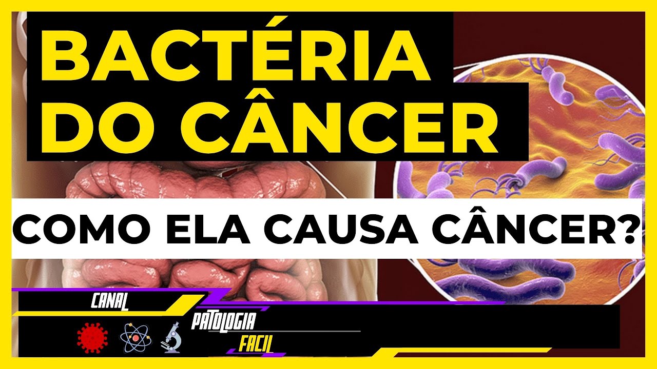 Mecanismo de Carcinogênese da bactéria Helicobacter Pylori [Câncer gástrico] [Patologia geral]