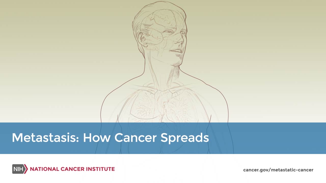 Metastasis: How Cancer Spreads