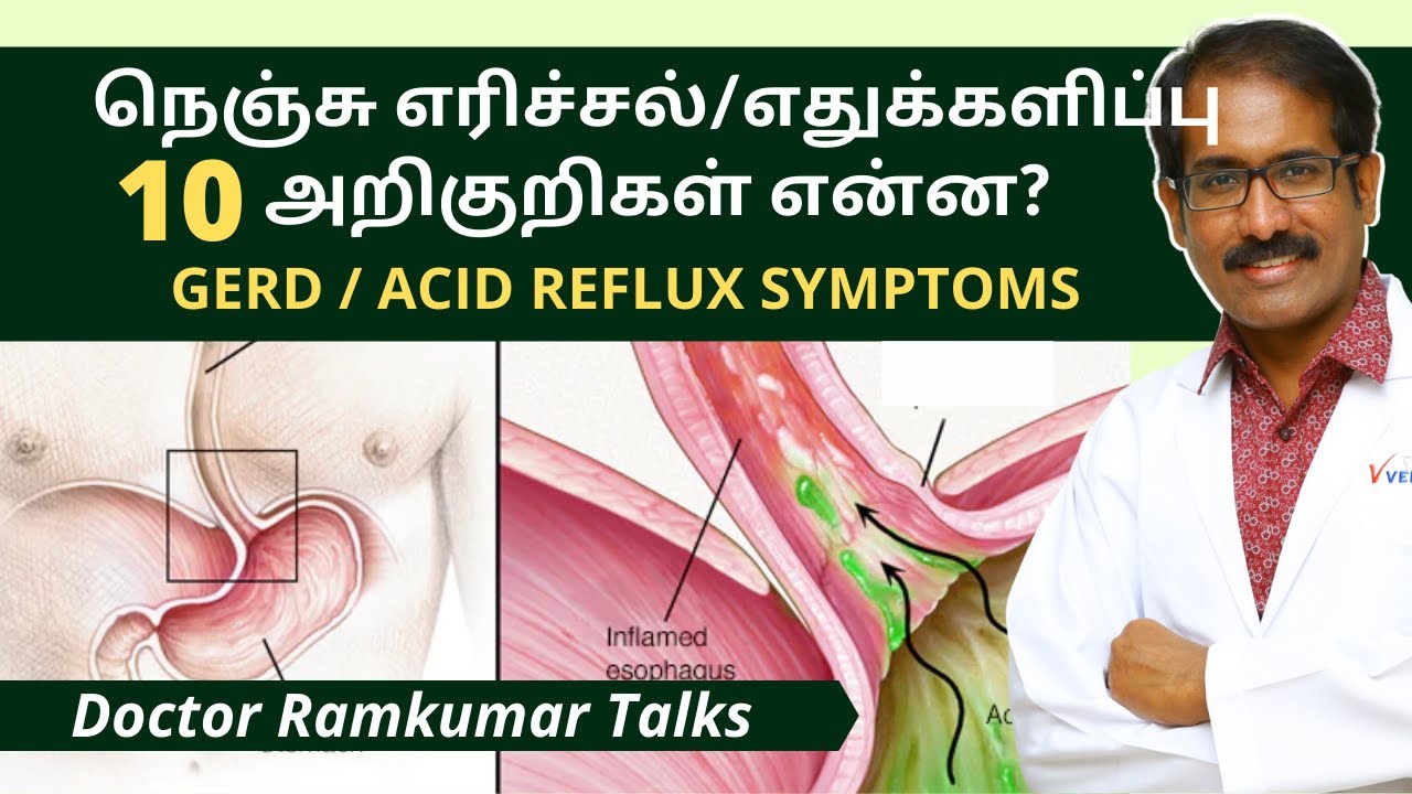 ACID REFLUX GERD HEART BURNS நெஞ்சு கரிப்பு எரிச்சல் எதுக்களிப்பு 10 அறிகுறிகள் என்ன? | GERD 2 Tamil