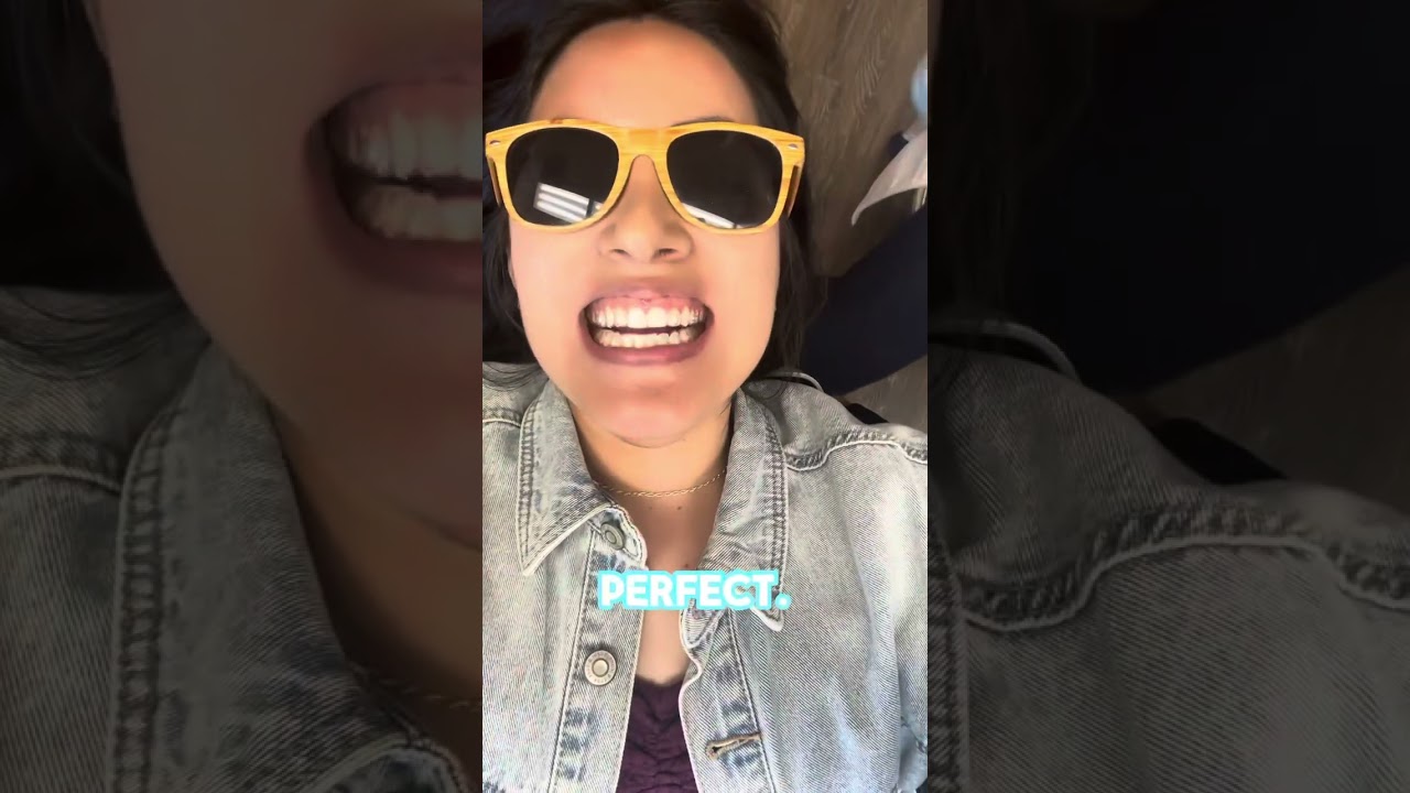 The start of my Spark Aligner Journey! #sparkaligners #clearaligners