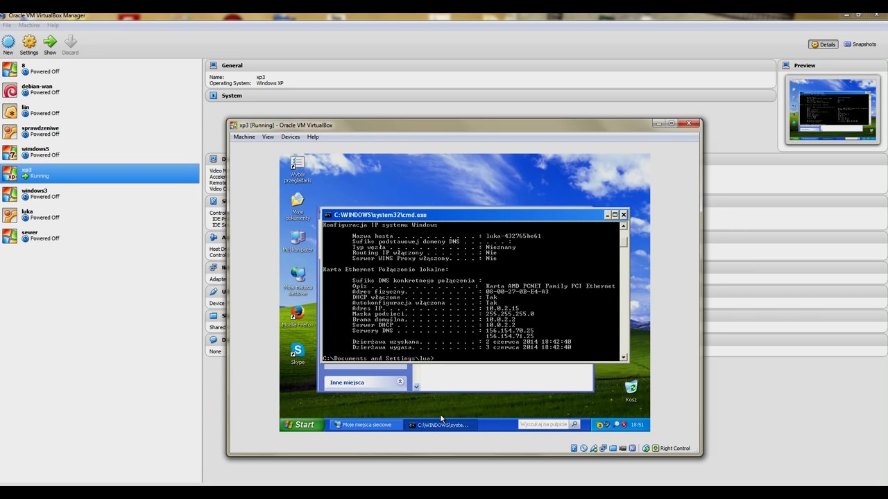 ustawienie karty sieciowej w systemie Windows XP