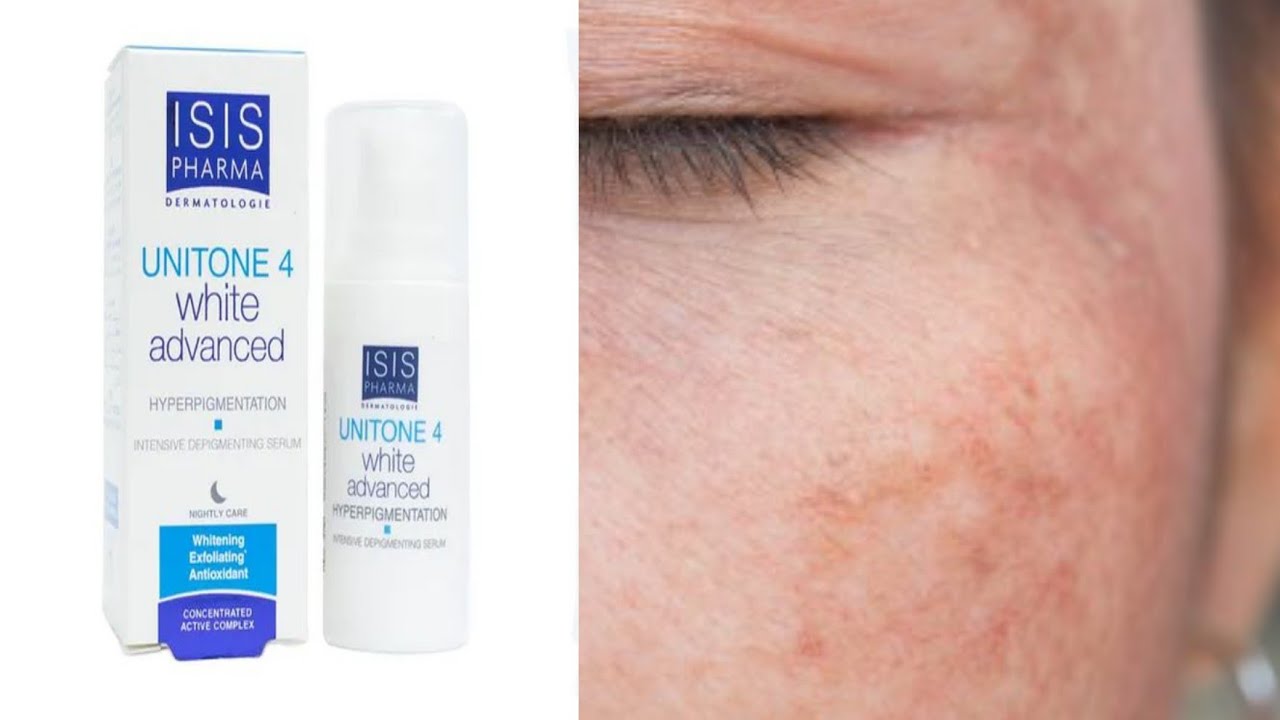 isispharma:unitone 4 advanced serum منتج بمزايا عديدة لعلاج التصبغات الجلدية
