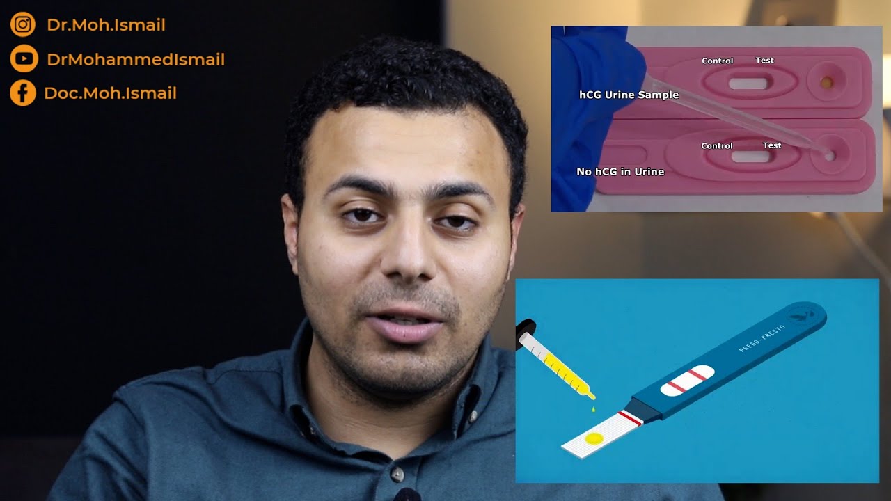 اختبار الحمل