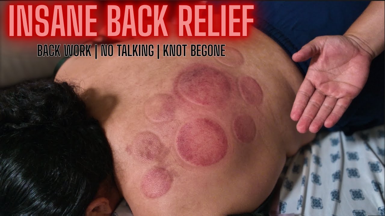 HUGE Back Knot MELTS Away — Deep Cupping ASMR (No Talking)