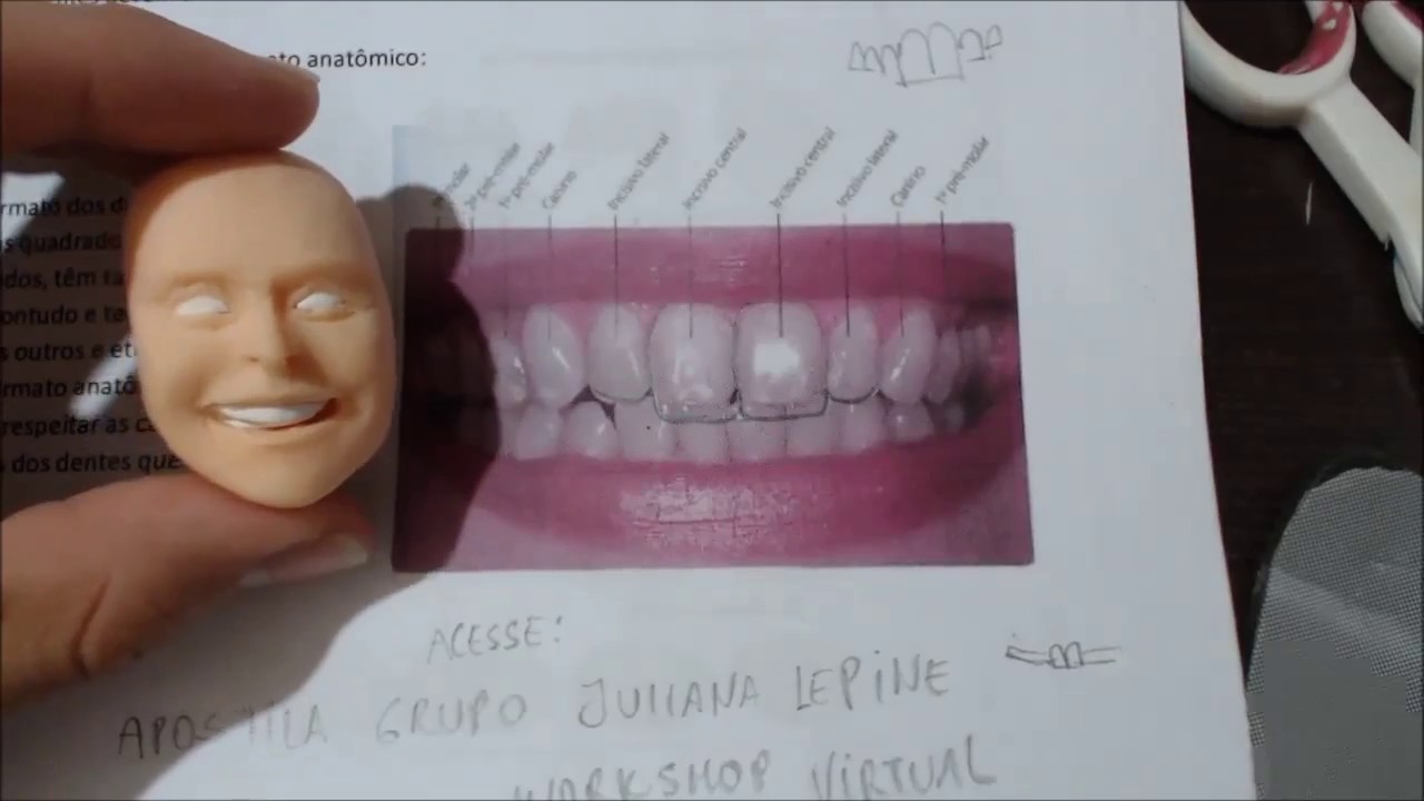 Dente em Biscuit para Caricatura- Luiz Costa