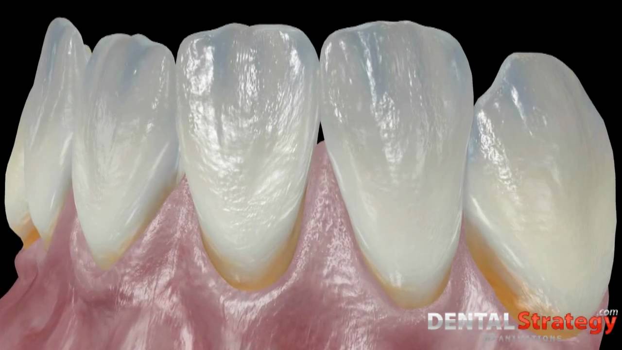 Morphology of the teeth and skull