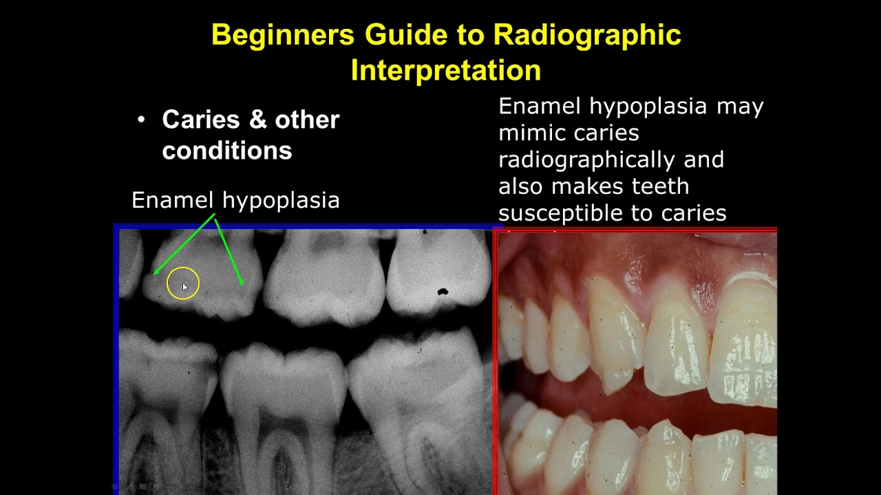 Radiographic Interpretation Section 2