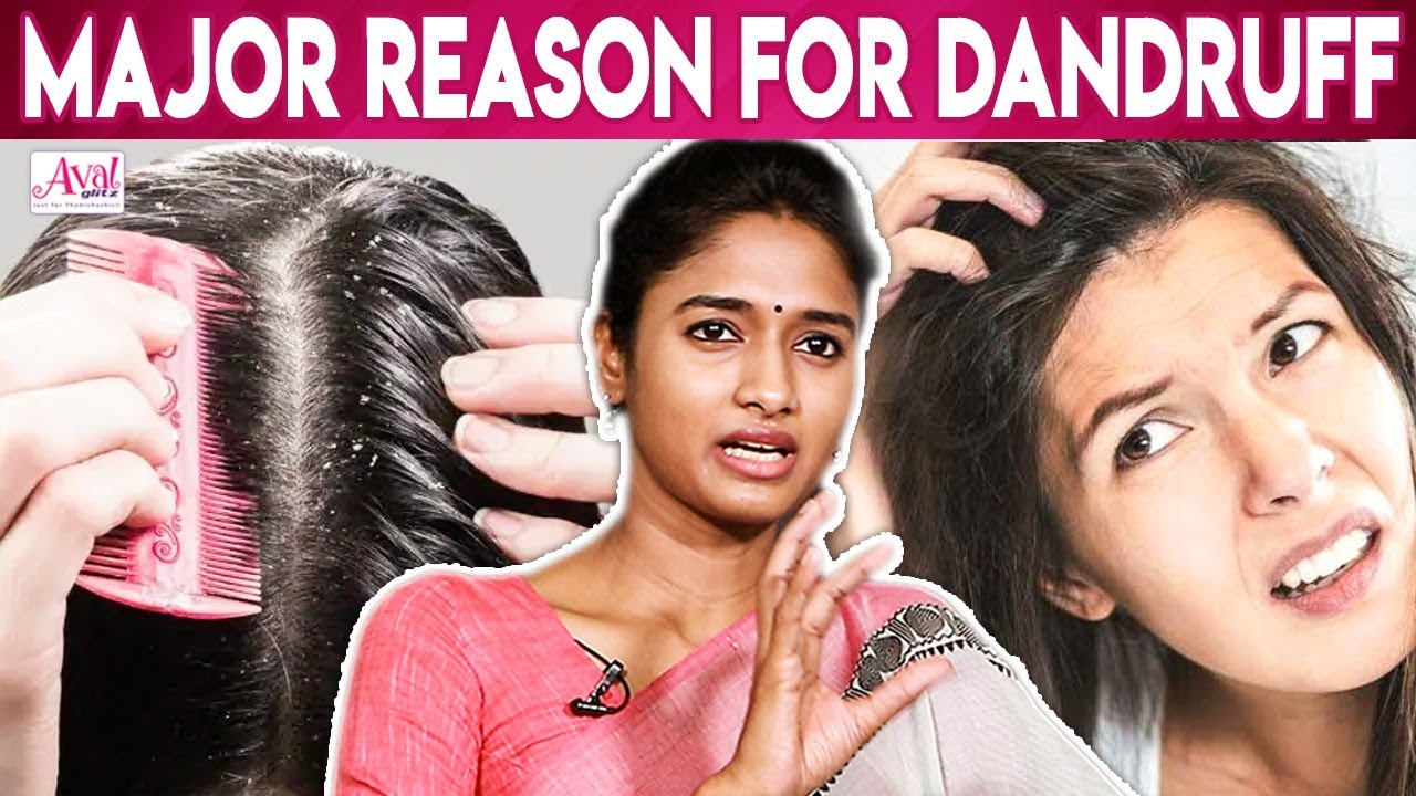 How To Remove Dandruff Fast - Dr Archana | Prevent Hair Loss , Hair Growth | Solution For Dandruff