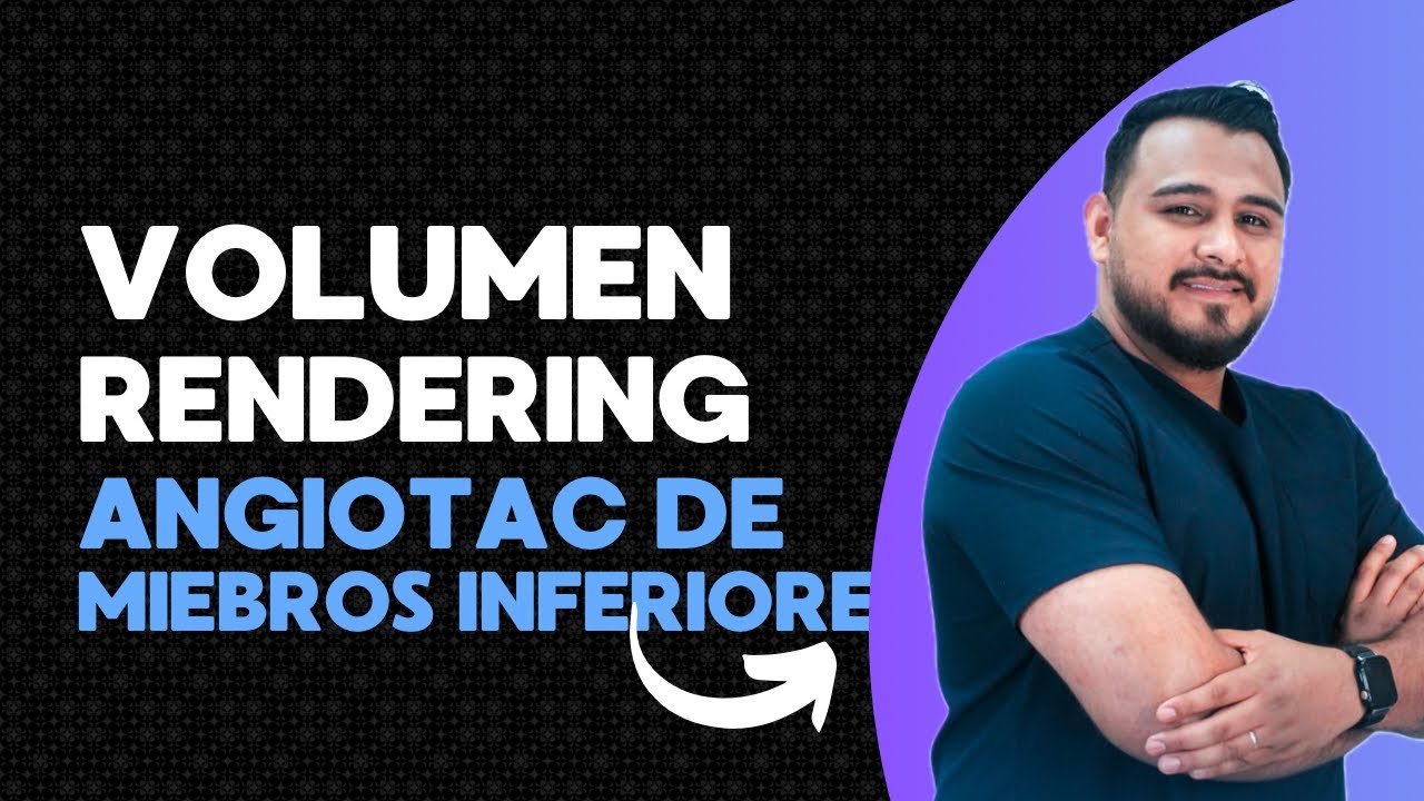 Volumen Rendering en Angio-TC de Miembros Inferiores | Radiología 3D paso a paso