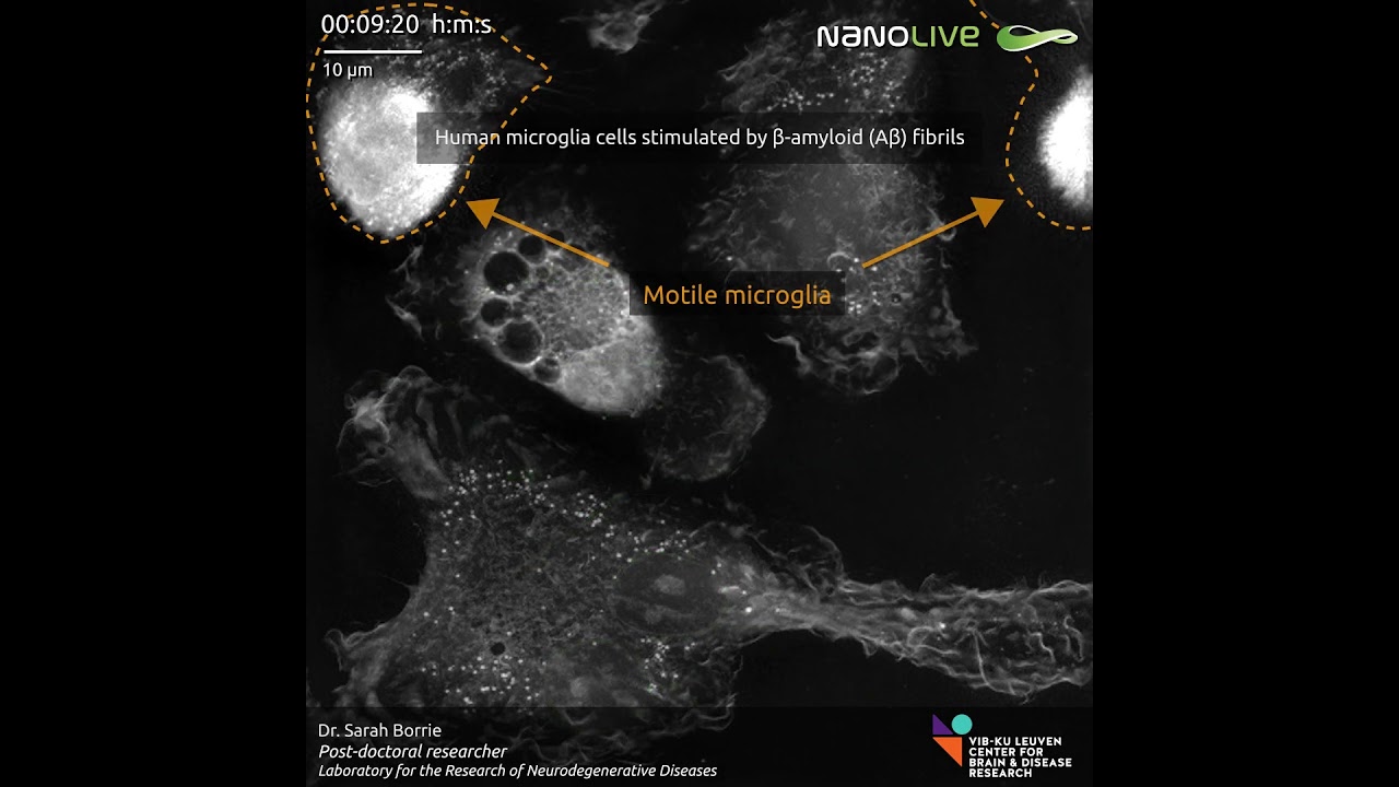 Label-Free Imaging Reveals Human Microglia Activation by Amyloid-Beta (A&beta;) Fibrils