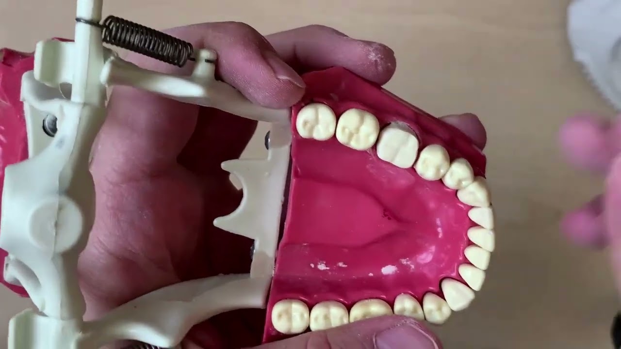 Alt Çene 1.Molar Diş Preparasyonu I Tooth Preparation I Mandibular First Molar