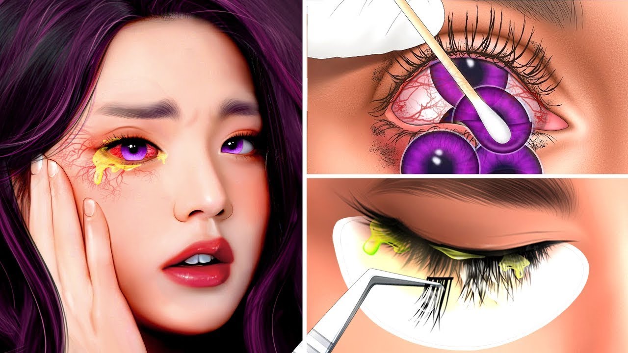 ASMR Contact lenses removal for Girl with her eye lense problems